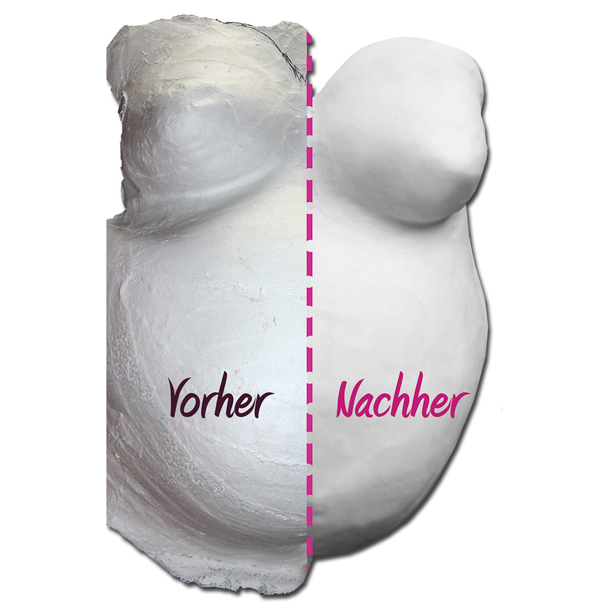 Mit dem Flächenveredelungsset wird die rauhe Oberfläche der Gipsbinden zu einem glatten Vorher/Nachher  Gipsabdruck vom Babybauch 